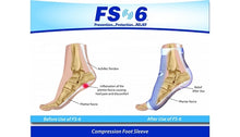 Load image into Gallery viewer, FS6 Compression Foot Sleeve