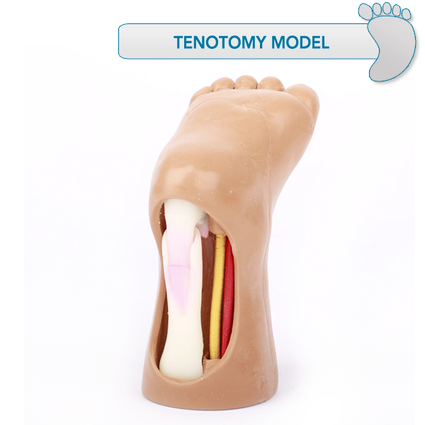 Tenotomy Model – Massons Healthcare